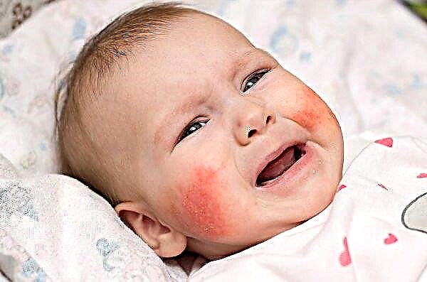 Hirsebrei während des Stillens: Ist es möglich, eine stillende Mutter im ersten Monat zu hirsen, und in Zukunft ist der Vorteil von GV, dass bei einem Baby eine Allergie vorliegt