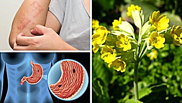 Primrose officinalis: beneficial properties, benefits and harms for women, with HB