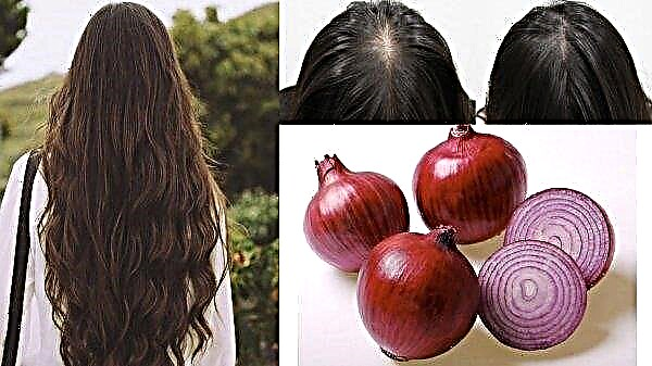 What is useful for onions for women: calorie content and chemical composition, benefits and harms, rules of use